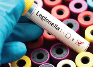 Five Practices to Prevent a Legionella Outbreak and Control Waterborne Pathogens