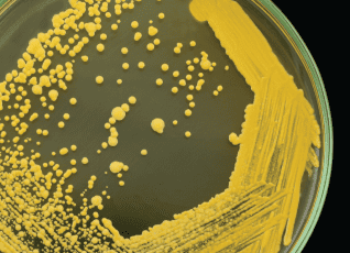 New Study Reveals the Role of Water Systems in Mycobacteria Contamination of Medical Devices
